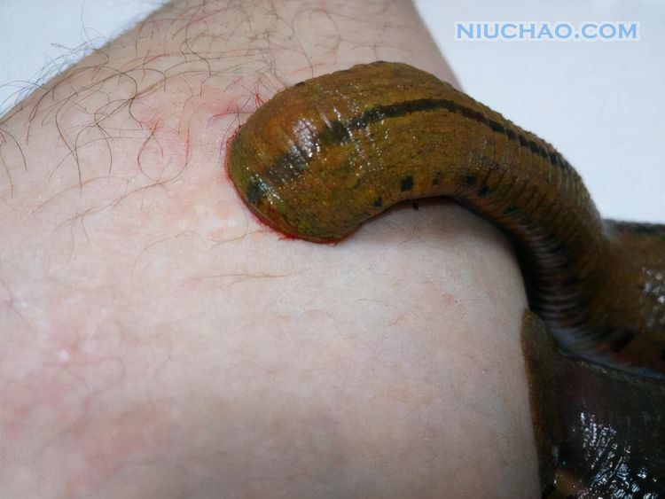 如果水蛭不小心被吃进胃里，它还能在胃里存活吗？